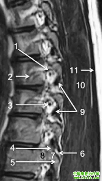 早读 | 胸、腰椎MRI解剖，9张高清图注帮你速记!
