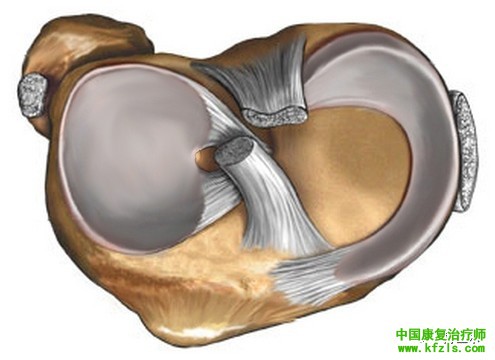 半月板损伤MRI诊断