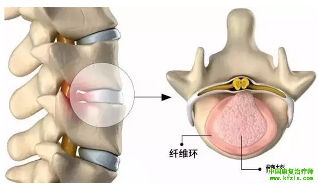 避免腰痛，这些运动不能练！