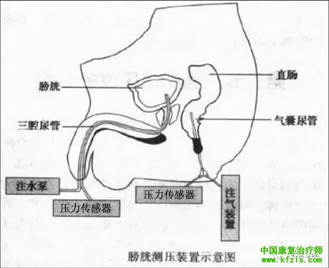 脊髓损伤患者尿动力学检查指南