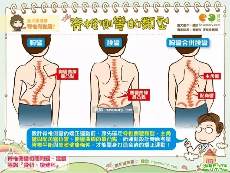 脊椎侧弯常见的类型评估与康复治疗