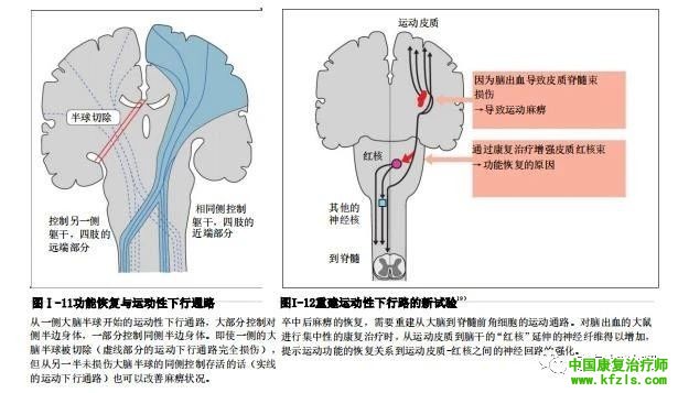 通过反复促通疗法（川平法，RFE）探讨偏瘫患者手指运动的恢复机制。