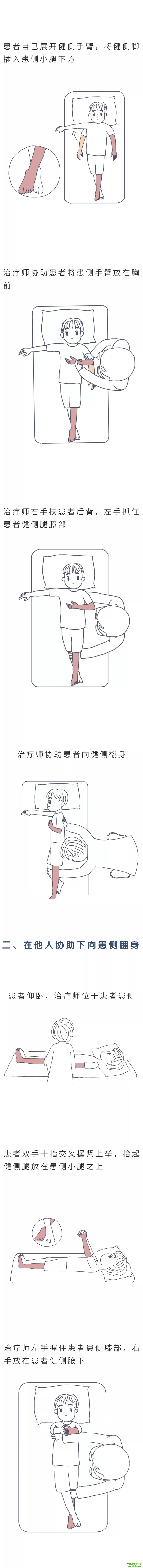 漫画 | 卧床脑卒中患者的训练（床上翻身训练）