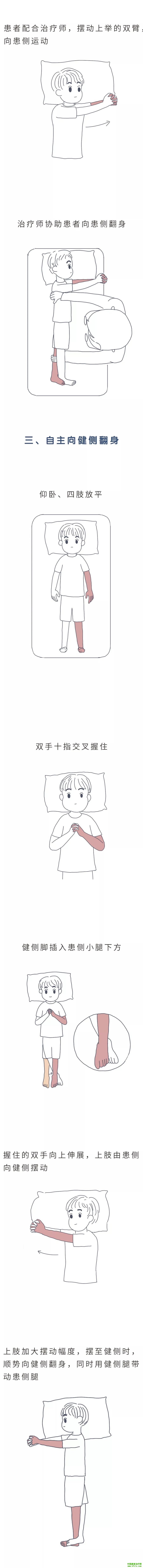 漫画 | 卧床脑卒中患者的训练（床上翻身训练）