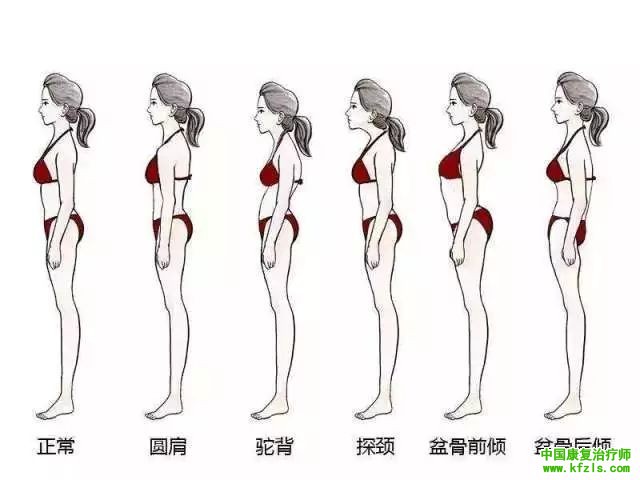 下交叉综合症的解剖分析与纠正训练