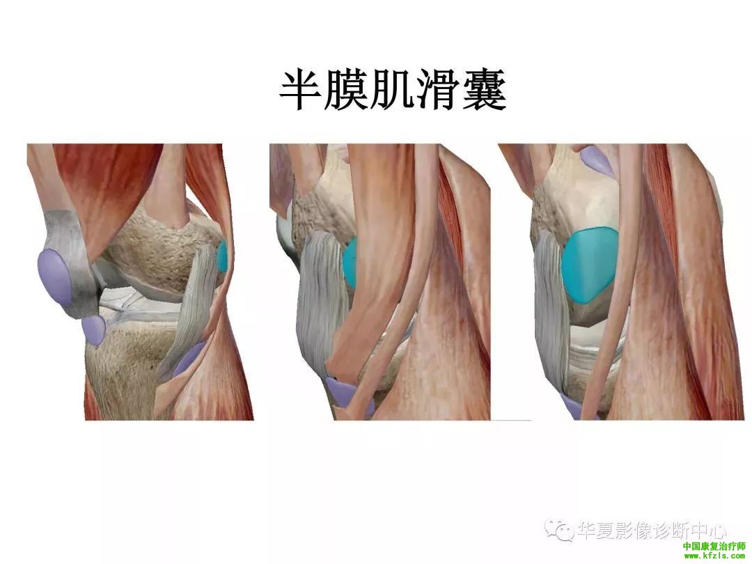 膝关节3D全彩解剖图谱