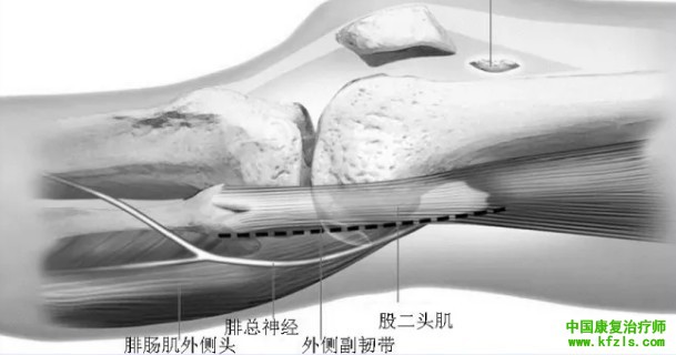 全面讲解Hoffa骨折