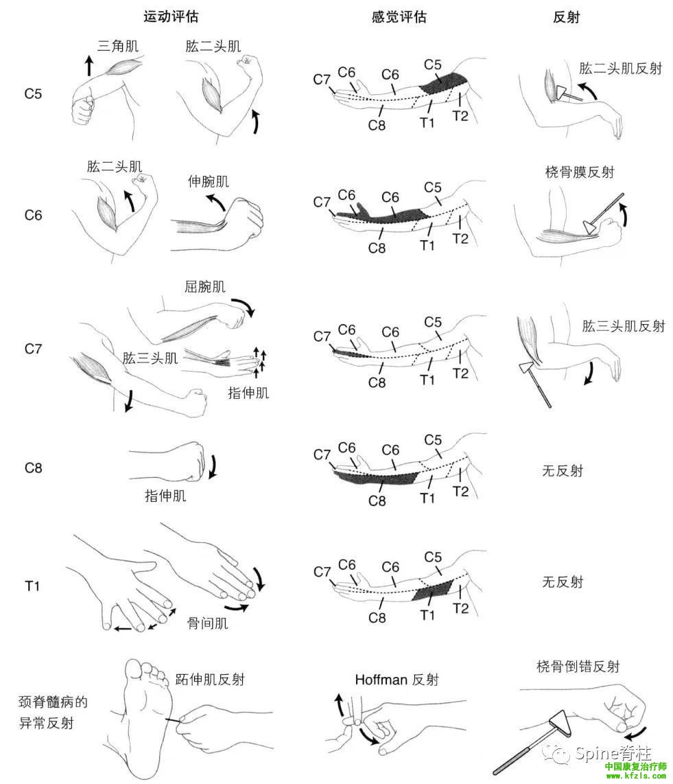 脊柱的神经支配及其相关疼痛，高清图文系统讲解！