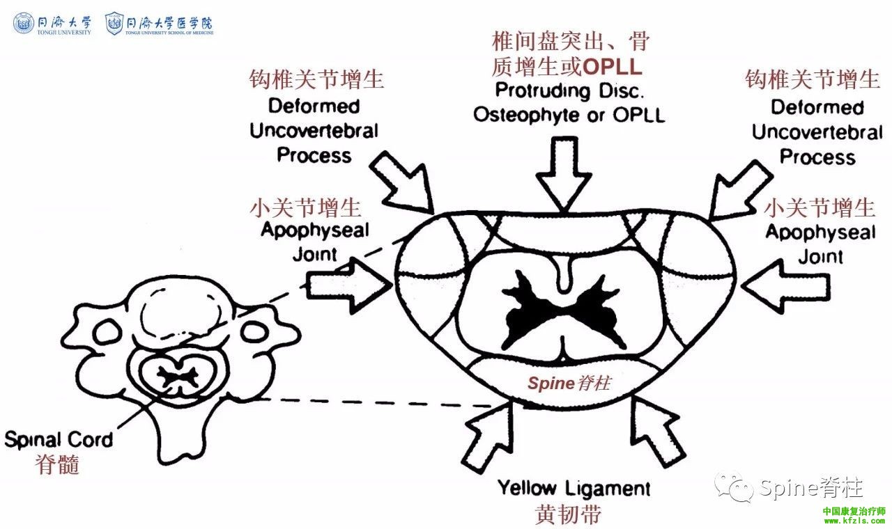 脊柱的神经支配及其相关疼痛，高清图文系统讲解！