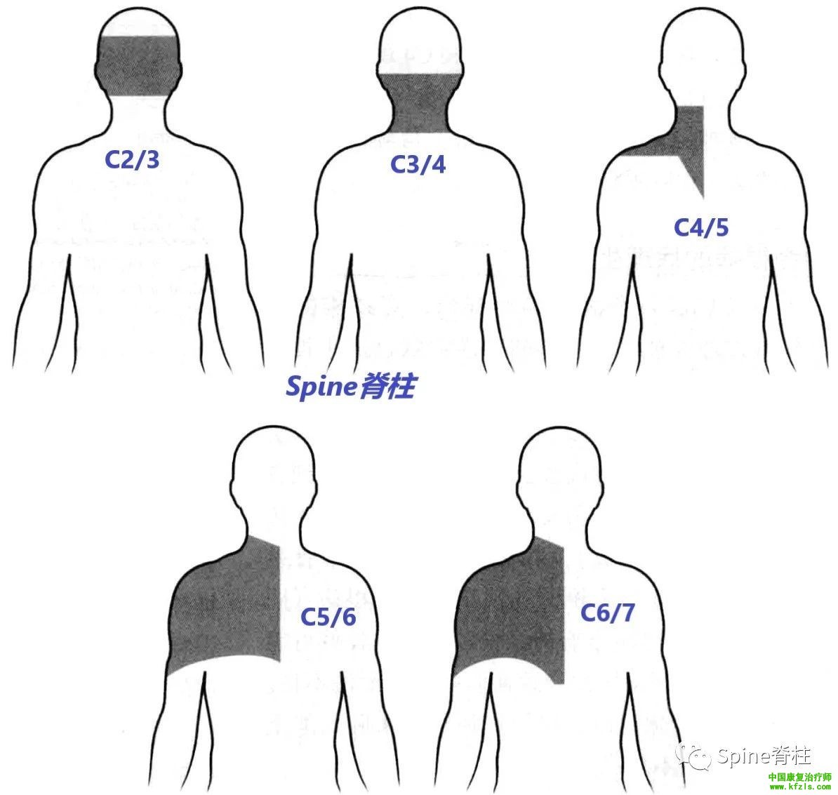 脊柱的神经支配及其相关疼痛，高清图文系统讲解！