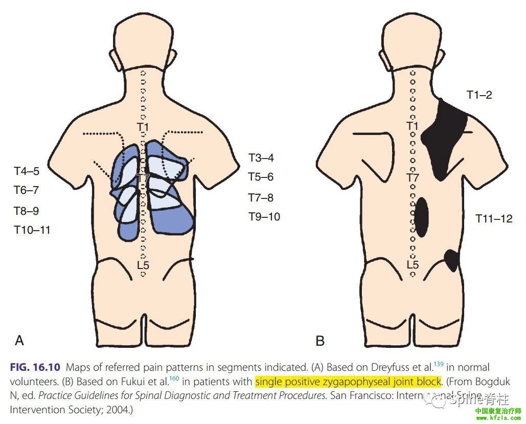 脊柱的神经支配及其相关疼痛，高清图文系统讲解！