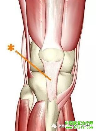 髌韧带损伤的机制与康复训练方法