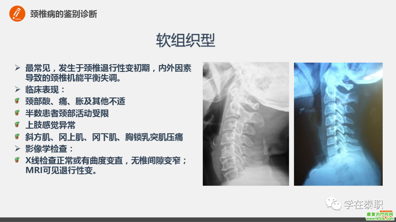 颈椎病的临床康复