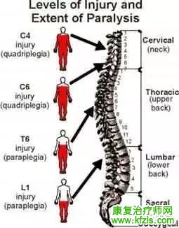 脊髓损伤康复