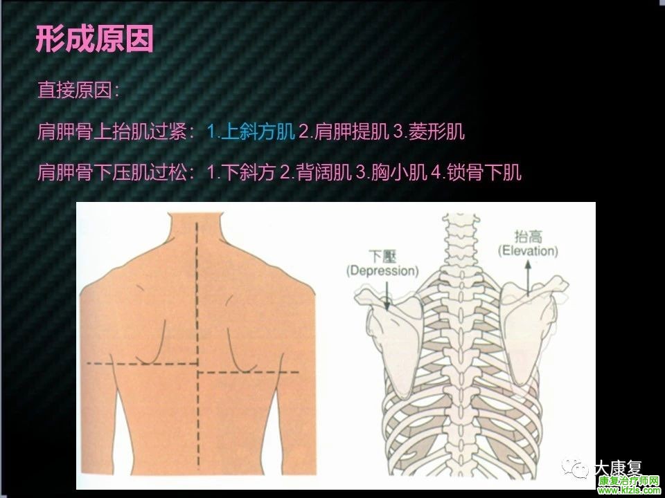 【收藏】肩关节功能解剖及康复方案