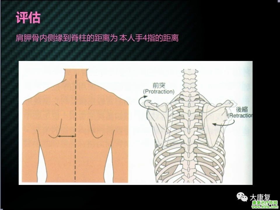 【收藏】肩关节功能解剖及康复方案