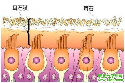 耳石症的康复训练
