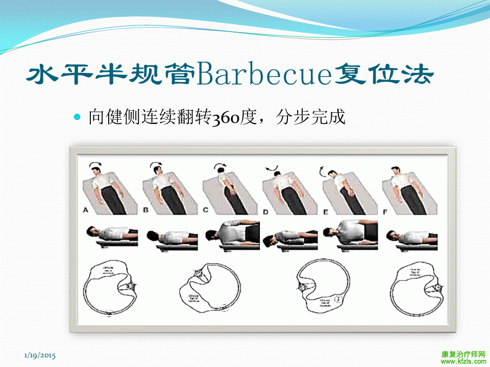 耳石症的康复训练