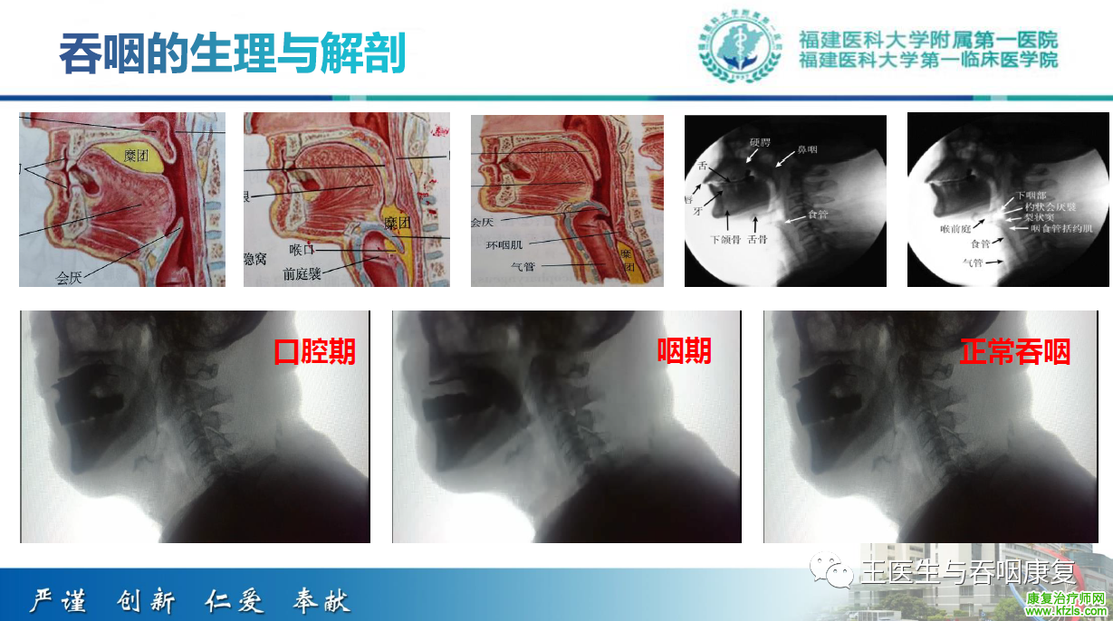 吞咽造影评估技术