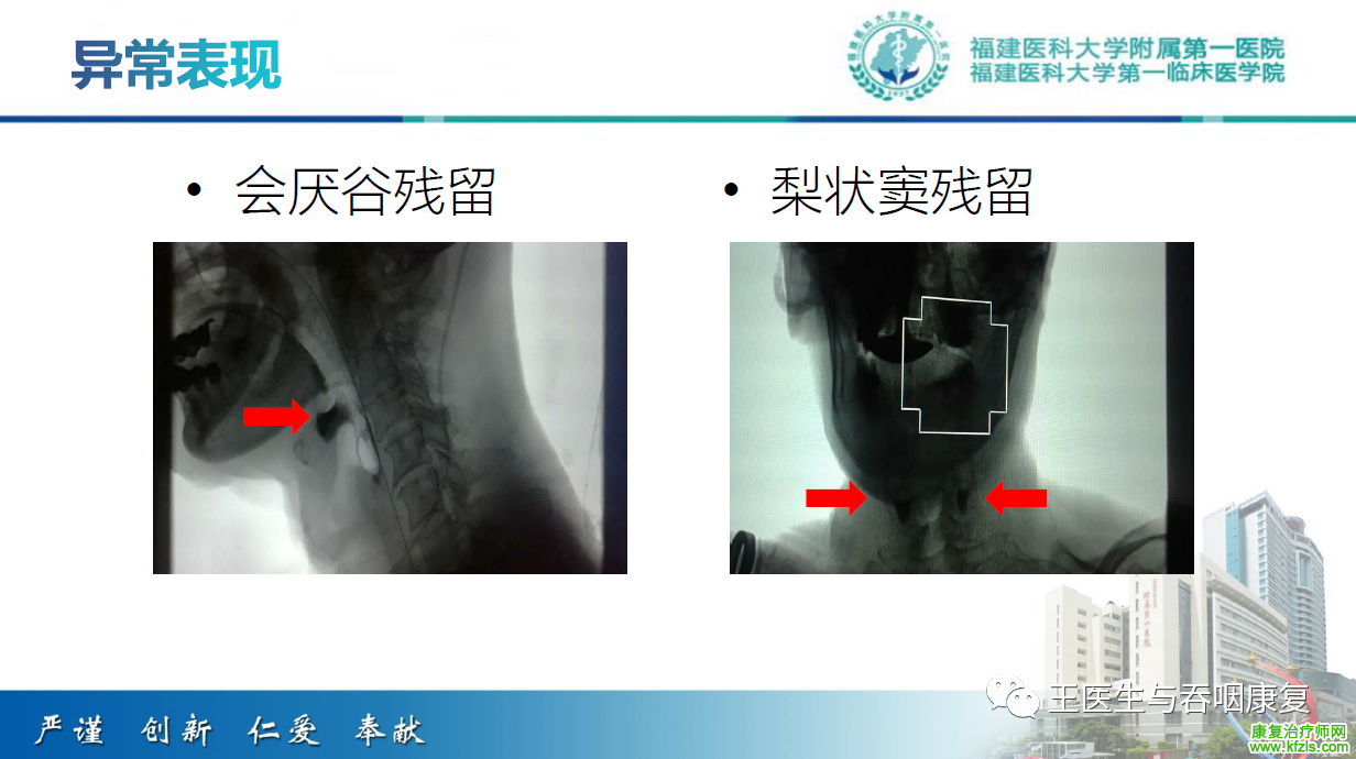 吞咽造影评估技术