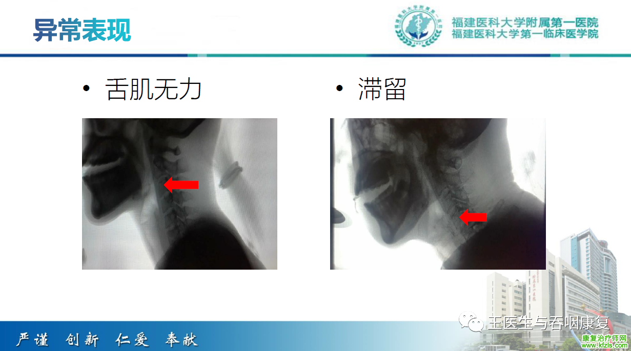 吞咽造影评估技术