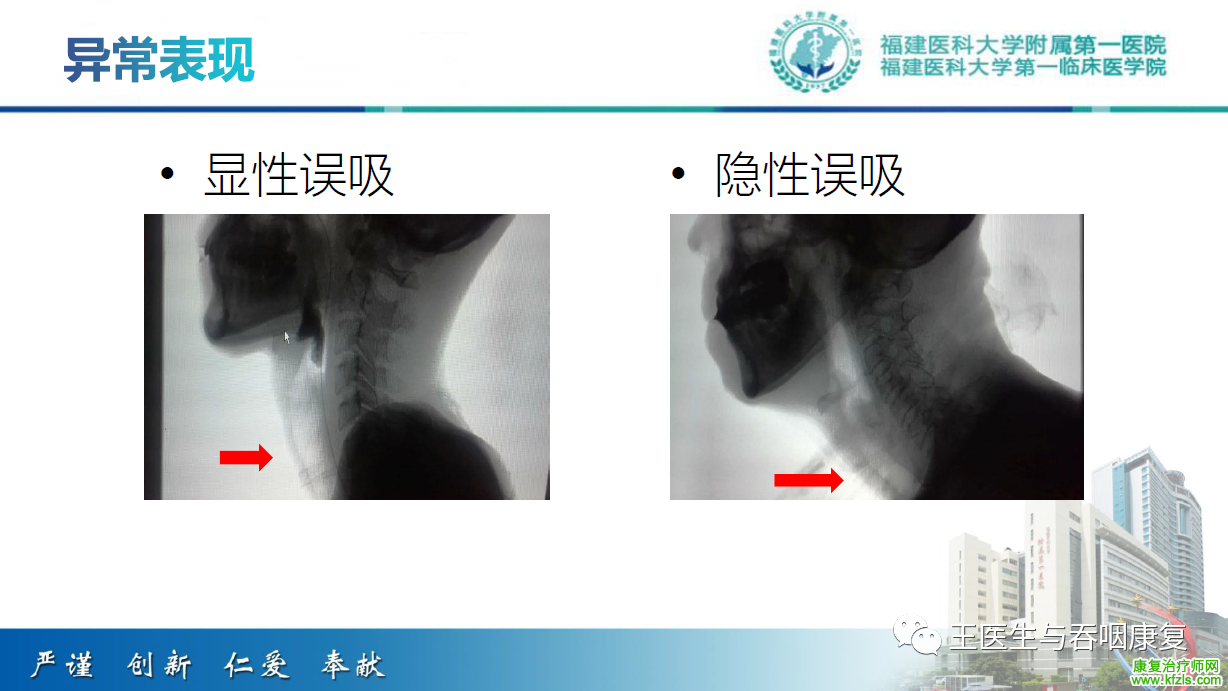 吞咽造影评估技术