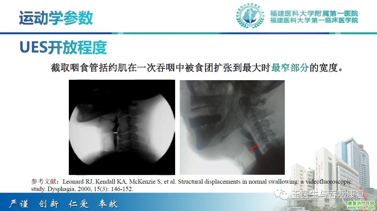 吞咽造影评估技术