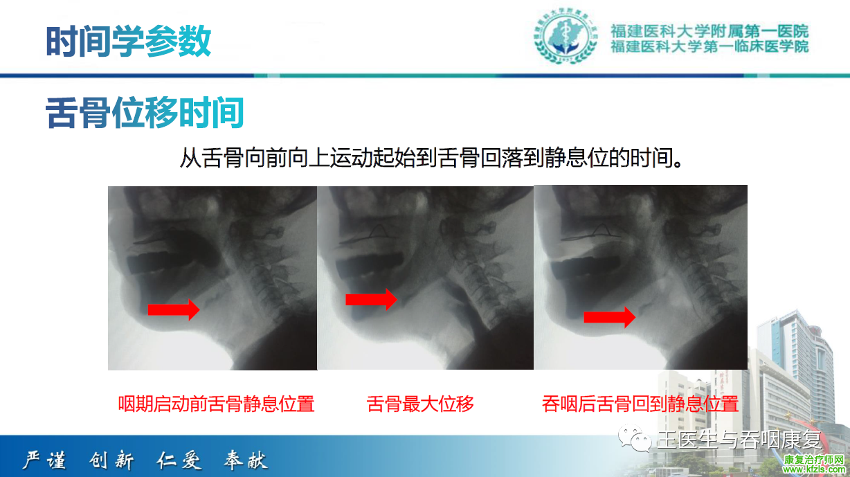 吞咽造影评估技术