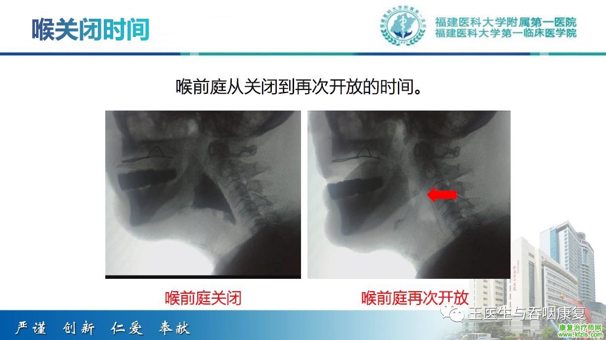 吞咽造影评估技术