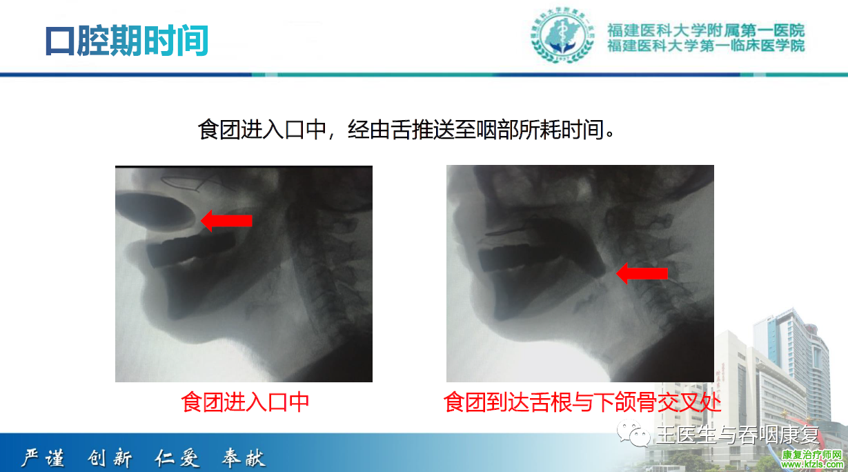 吞咽造影评估技术