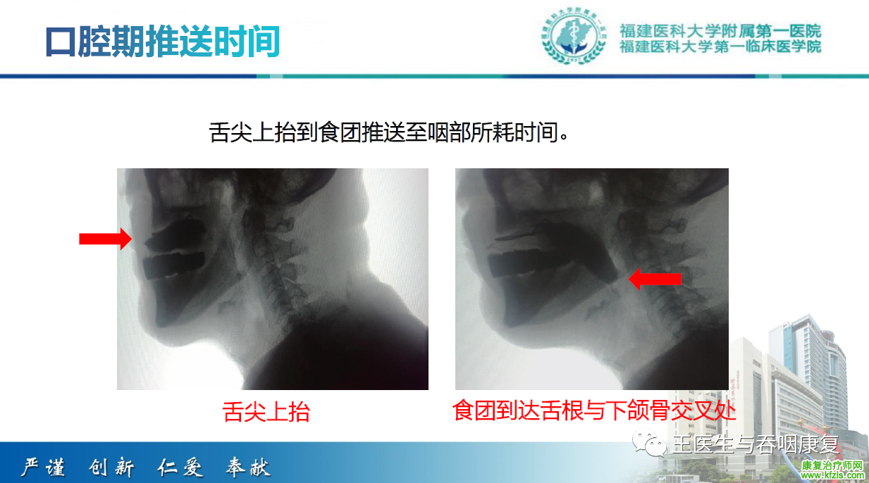 吞咽造影评估技术