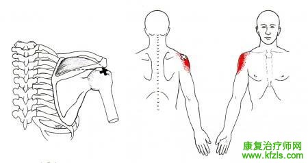 28块肌肉激痛点以及疼痛模式