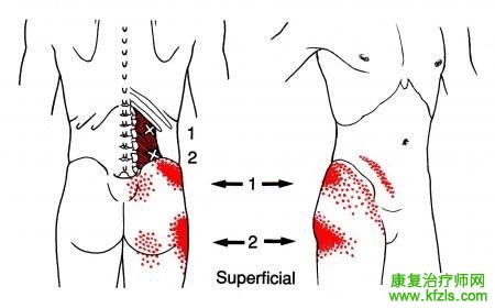 28块肌肉激痛点以及疼痛模式