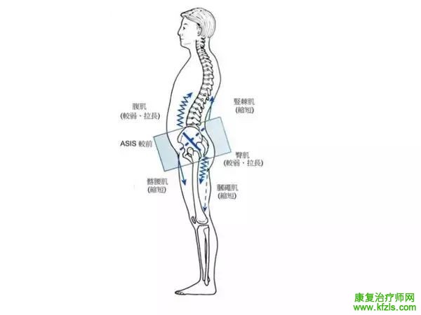 收藏！骨盆前后、上下倾斜的康复治疗！