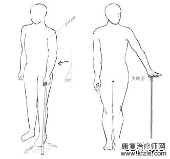 全面讲解髋关节置换术后的康复训练！