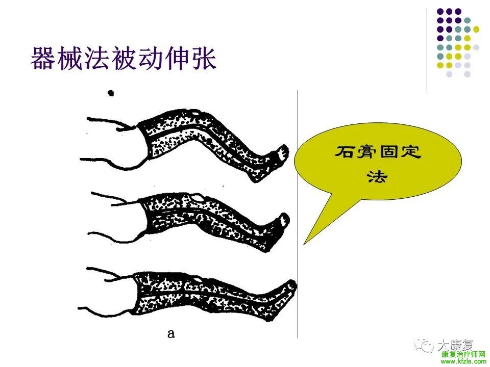 Bobath疗法痉挛期康复训练