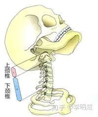 颈后大包如何系统康复纠正？