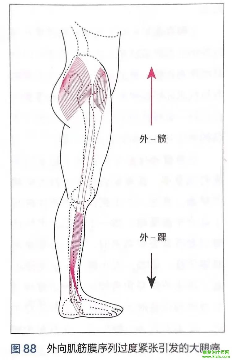 姿势代偿与肌筋膜有什么联系？