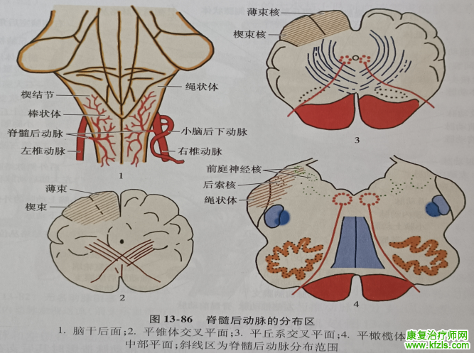 脑干梗死