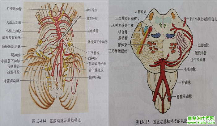 脑干梗死