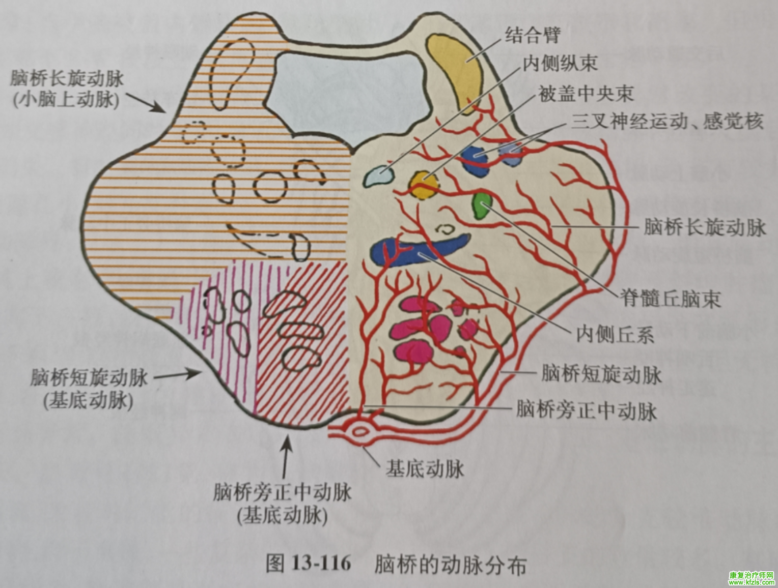 脑干梗死