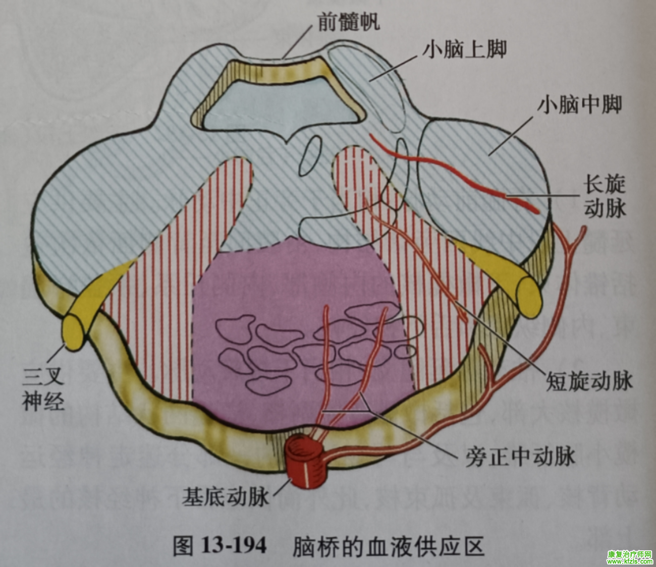 脑干梗死