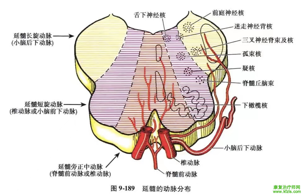 脑干梗死