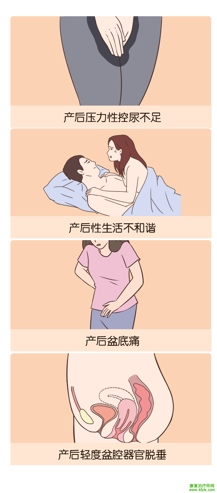 盆底训练