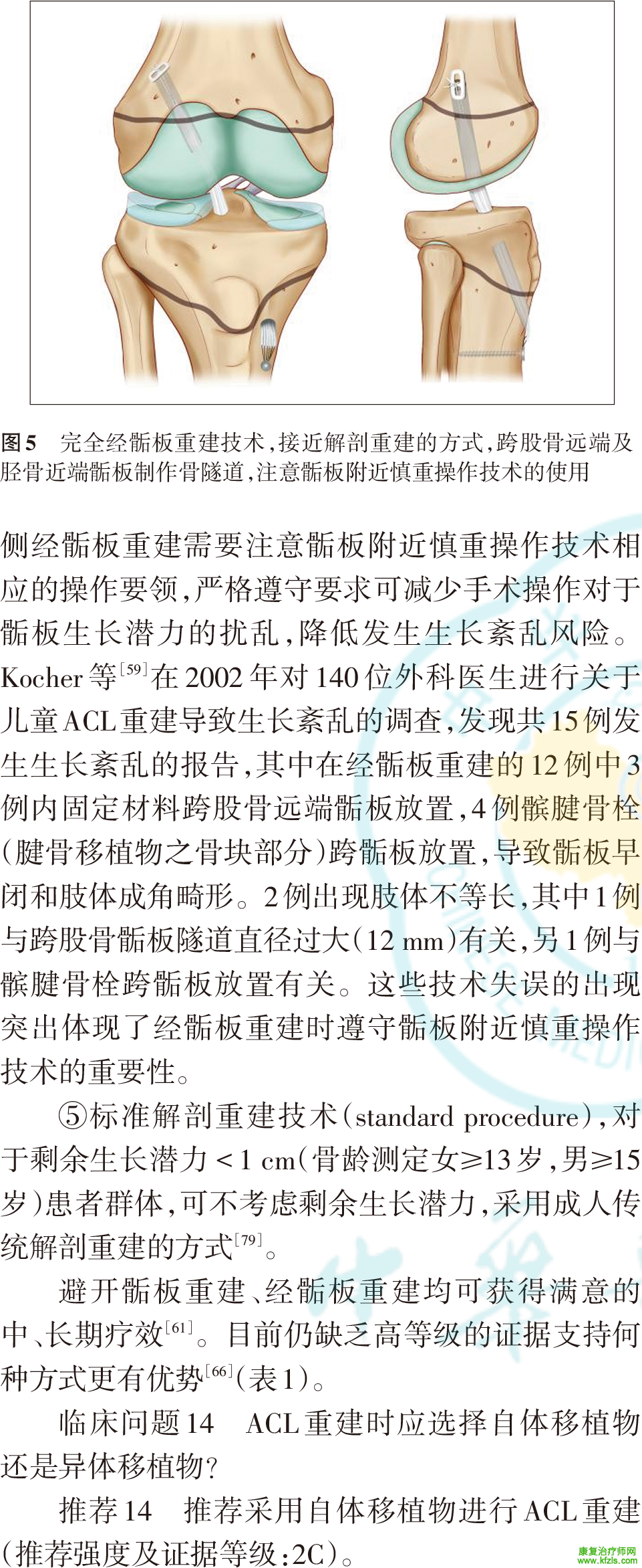 儿童与青少年前十字韧带损伤诊疗的25条建议