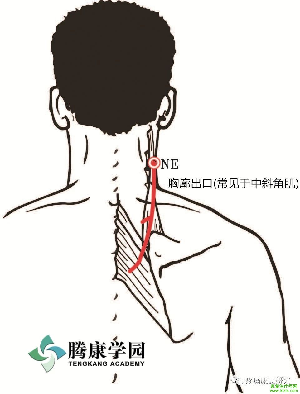 肩关节周围11条神经的解剖