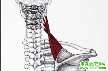 总结：可能引发肩关节疼痛的肌肉