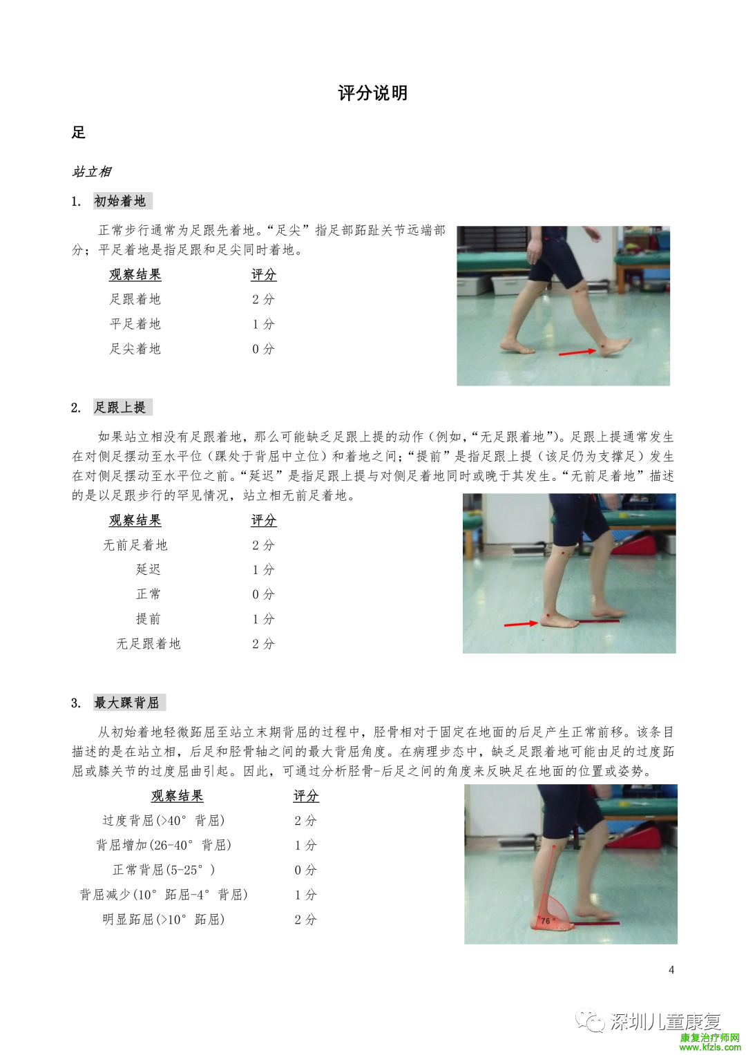 爱丁堡视觉步态评分