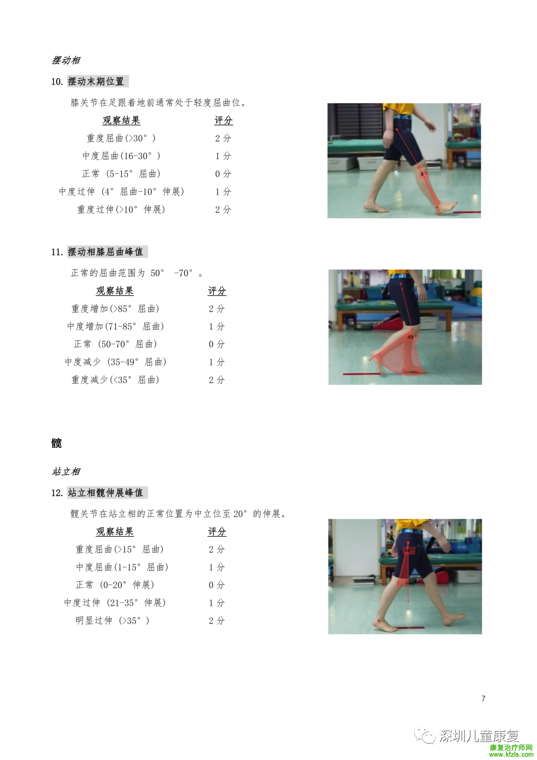 爱丁堡视觉步态评分